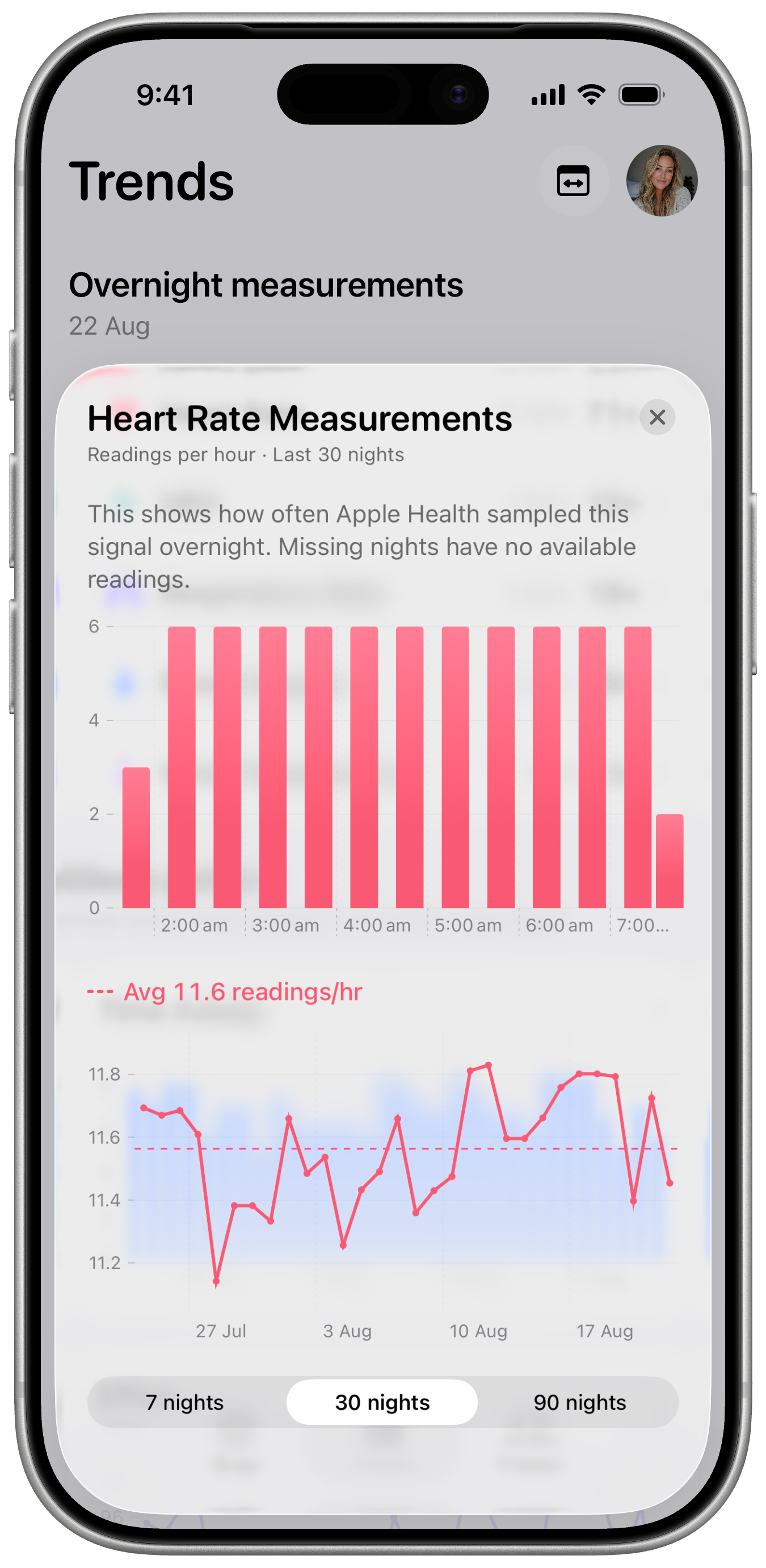SleepKit showing heart rate measurements over 30 nights