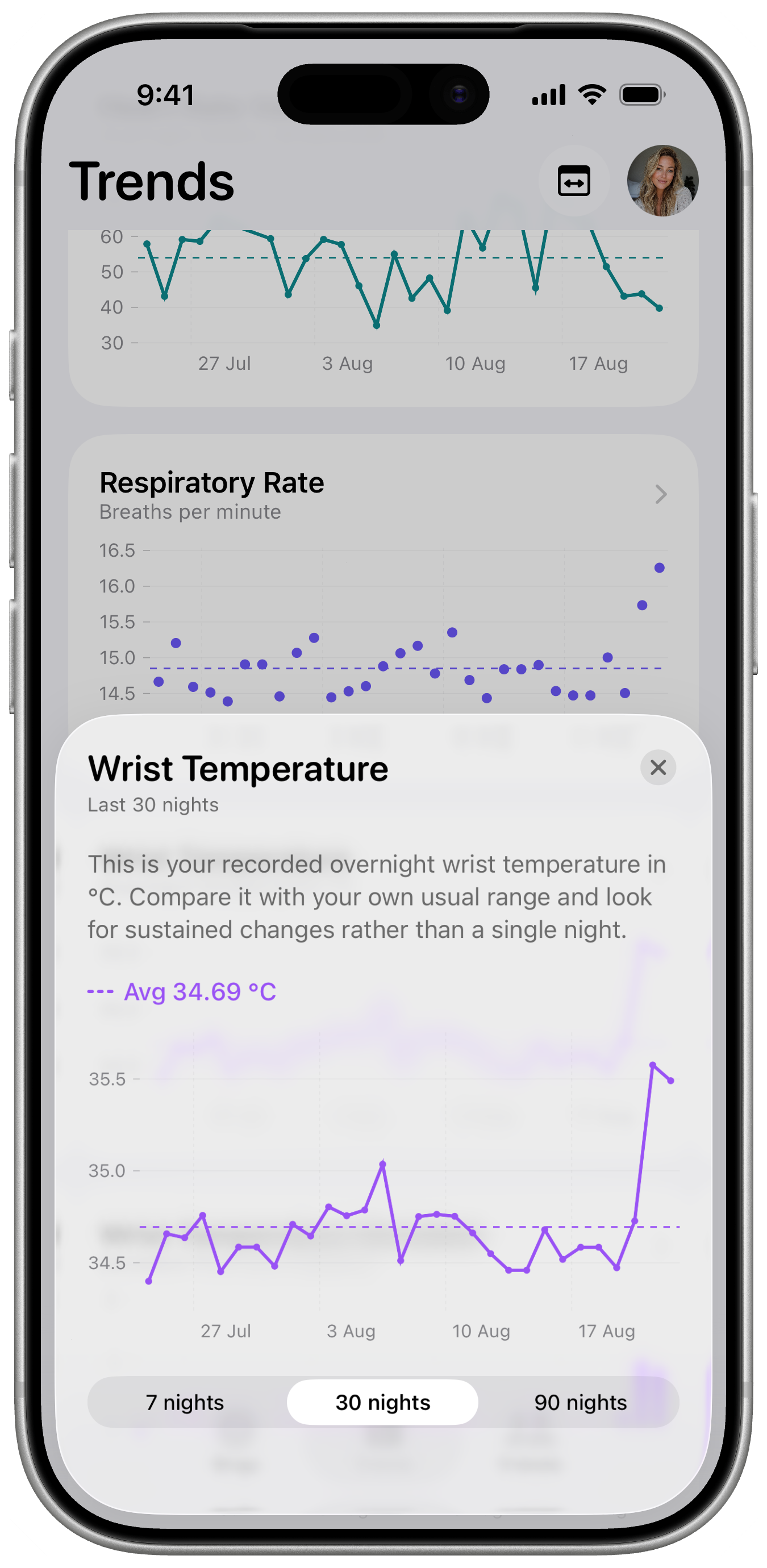 SleepKit showing an overnight wrist temperature measurement over 30 nights